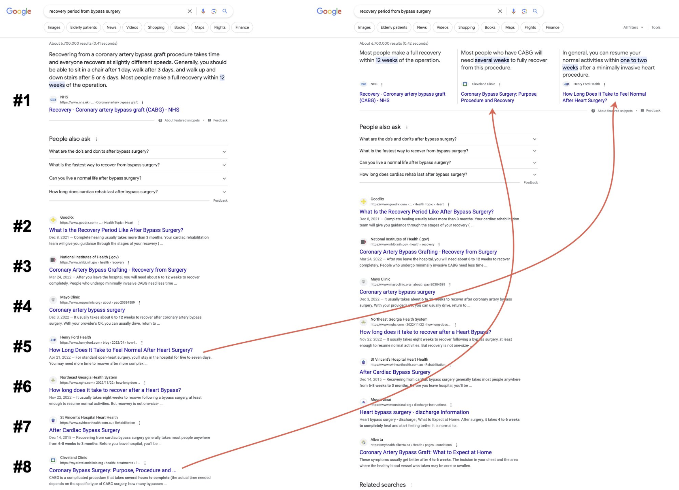 Google: Vergleich zweier Suchergebnisseiten - eine mit normalem Featured Snippet, eine mit Triple Featured Snippet
